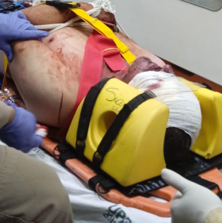 Mulher revida violência e agride companheiro no rosto, em Cascavel