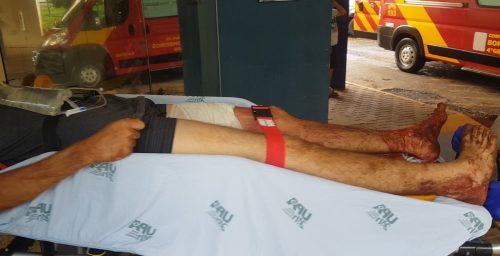 Jovem é baleado no Sanga Funda; Quarta vítima no mesmo local somente hoje